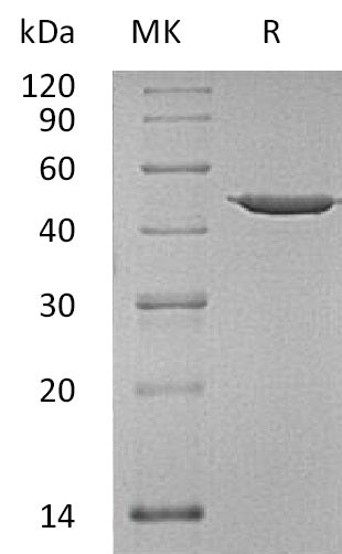 ANXA7 Protein, Human