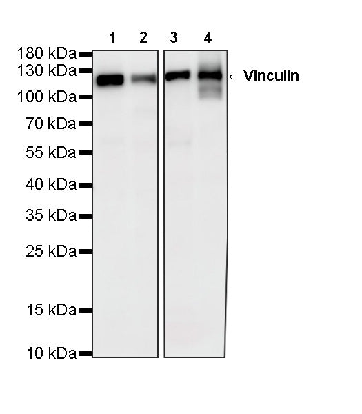 Vinculin Recombinant Rabbit mAb (S-5405)