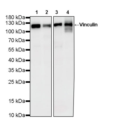 Vinculin Recombinant Rabbit mAb (S-5405)
