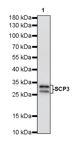 SCP3 Recombinant Rabbit mAb (S-6025)