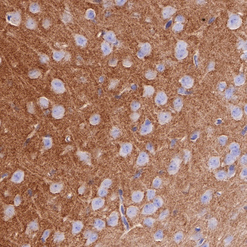 Nectin-1/PVRL1 Recombinant Rabbit mAb (S-279-140)