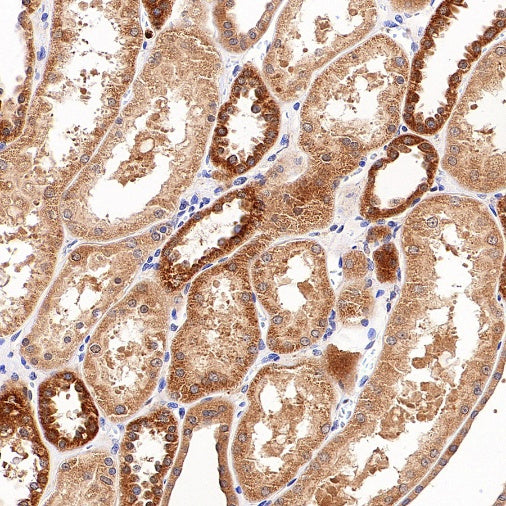 IFIH1 Recombinant Rabbit mAb (S-2413-49)