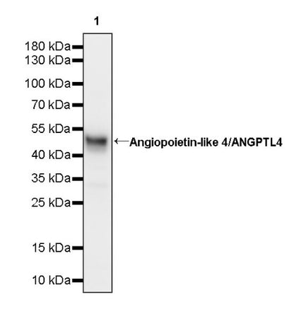 Angiopoietin-like 4/ANGPTL4 Recombinant Rabbit mAb (S-1605-42)