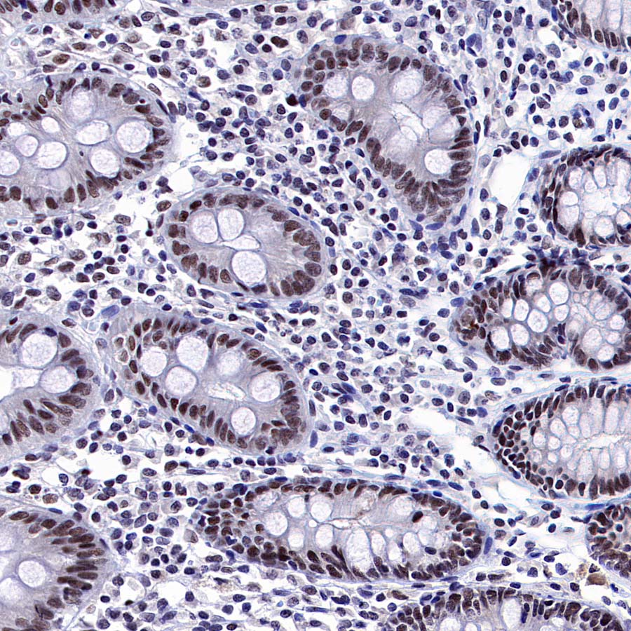 DGCR8 Recombinant Rabbit mAb (S-4082-6)