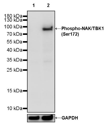 Phospho-NAK/TBK1 (Ser172) Recombinant Rabbit mAb (S-3182)