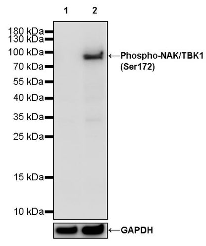 Phospho-NAK/TBK1 (Ser172) Recombinant Rabbit mAb (S-3182)