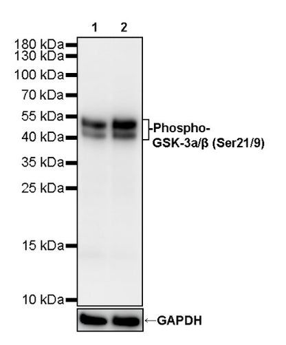 Phospho-GSK3a/β (Ser21/9) Recombinant Rabbit mAb (S-3304)