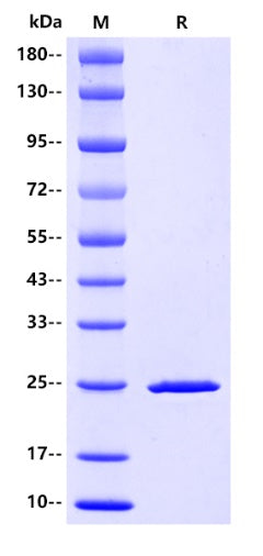 HIV (HIV1-HXB2) P24 Protein, His tag