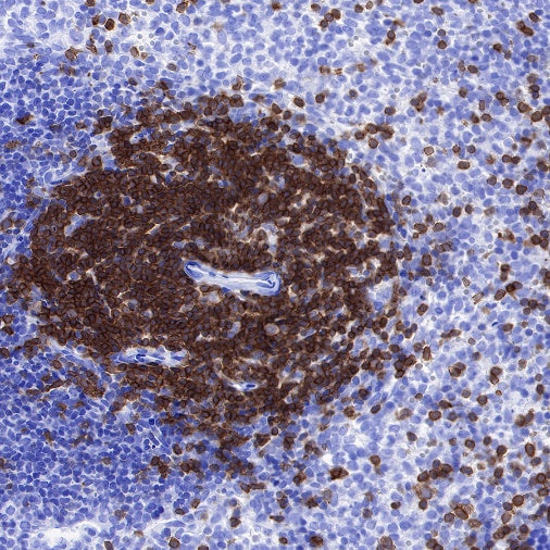 Lck Recombinant Rabbit mAb (SDT-316-15)