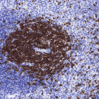 Lck Recombinant Rabbit mAb (SDT-316-15)