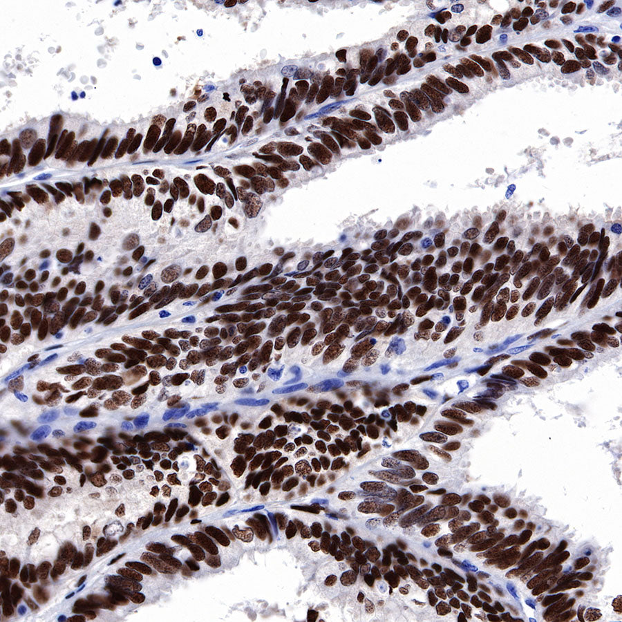 Progesterone Receptor Recombinant Rabbit mAb (SDT-R123)