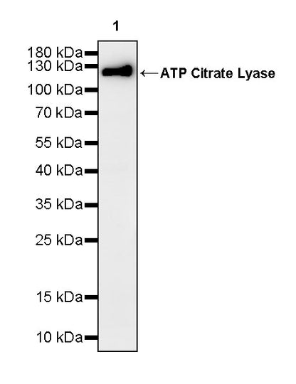 ATP Citrate Lyase Recombinant Rabbit mAb (S-5036)