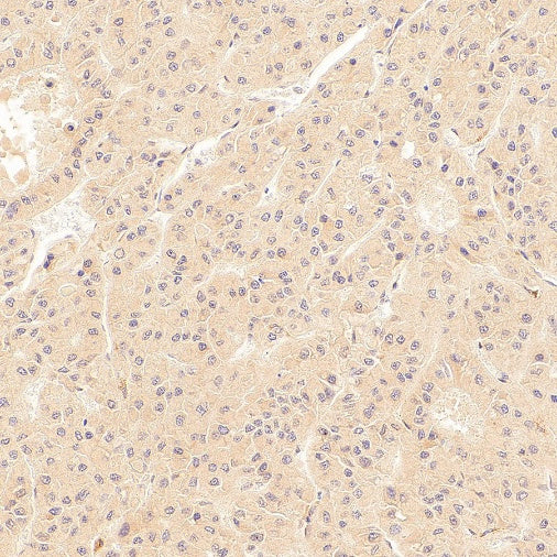 SOCS2 Recombinant Rabbit mAb (S-4956-21)
