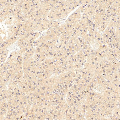 SOCS2 Recombinant Rabbit mAb (S-4956-21)
