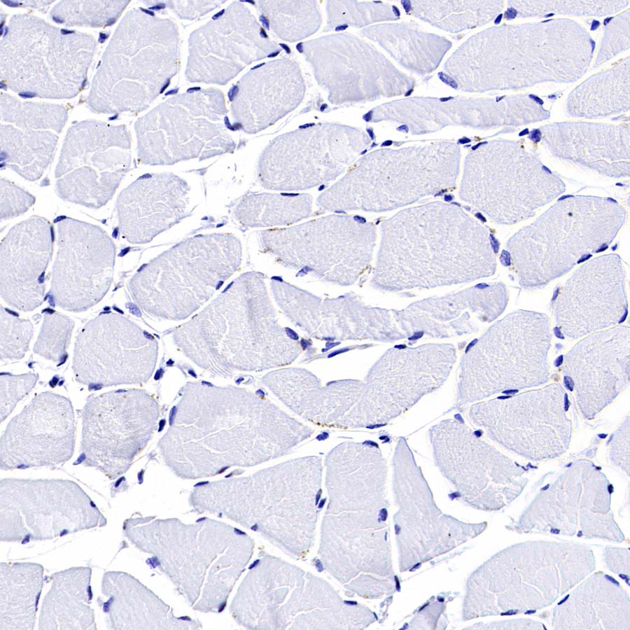 Pklr Recombinant Rabbit mAb (S-4114-40)