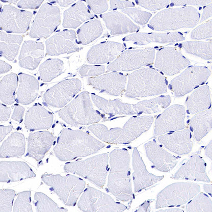 Pklr Recombinant Rabbit mAb (S-4114-40)