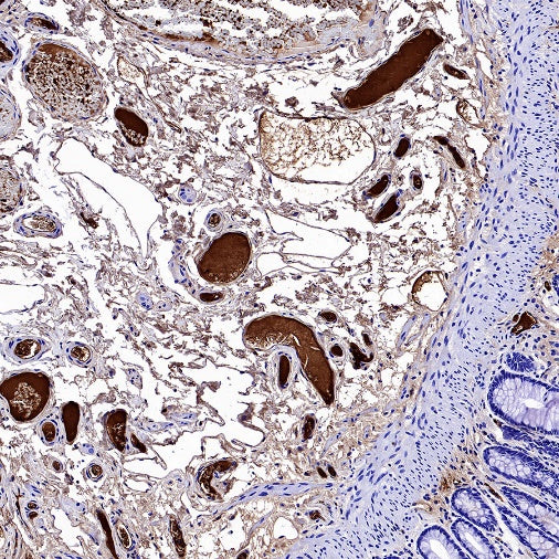 AACT Recombinant Rabbit mAb (S-897-109)