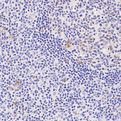 TNFRSF17/BCMA Recombinant Rabbit mAb (S-4674)