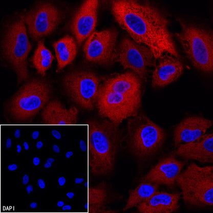 FASN Recombinant Rabbit mAb (Alexa Fluor® 594 Conjugate) (S-682-32)