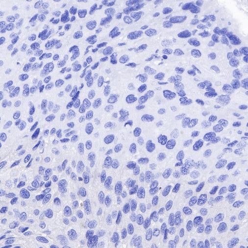 NeuN Recombinant Rabbit mAb (SDT-432-1)