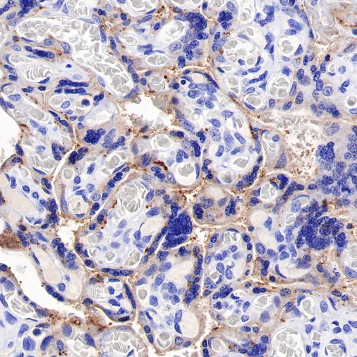 Human folate receptor alpha Recombinant Rabbit mAb (SDT-719-20-2)