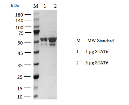 STAT6 His Tag Protein, Human