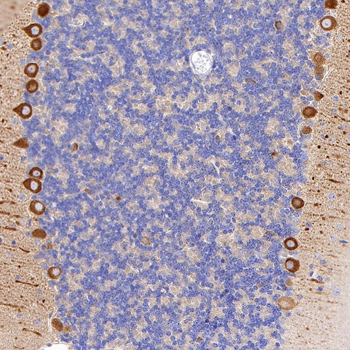 KIF3A Recombinant Rabbit mAb (S-1083-9)