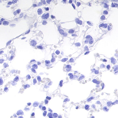 Synapsin-1 Recombinant Rabbit mAb (S-550-7)