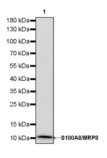 S100A8/MRP8 Recombinant Rabbit mAb (S-R251)