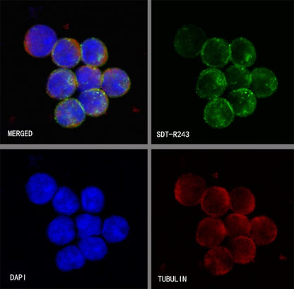HLA-DP alpha1 Recombinant Rabbit mAb (S-R243)