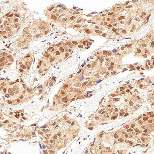 SMN2 Recombinant Rabbit mAb (S-4920-4)