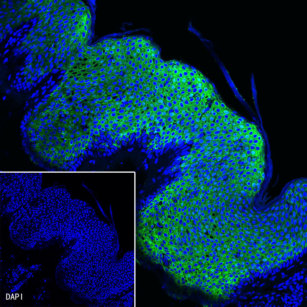 Keratin 10 Recombinant Rabbit mAb (SDT-124-6)