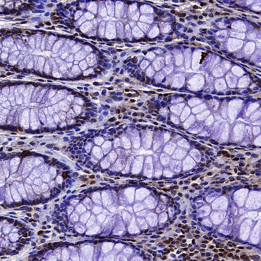eIF6 Recombinant Rabbit mAb (S-4171-13)