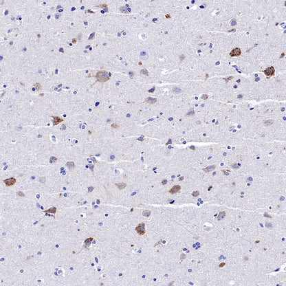 SEZ6 Recombinant Rabbit mAb (SDT-2097-7)
