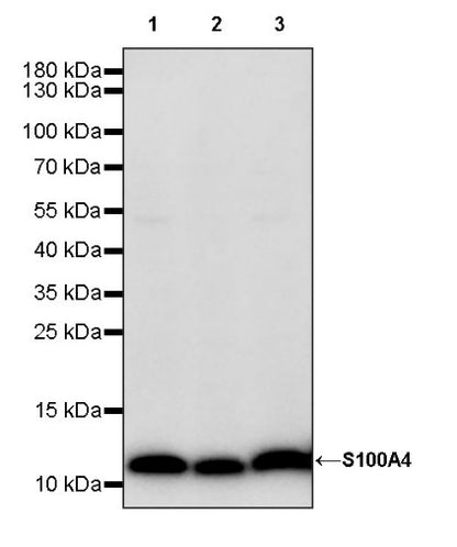 S100A4 Recombinant Rabbit mAb (S-1655-26)
