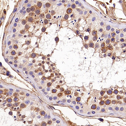 EEA1 Recombinant Rabbit mAb (S-2604-39)