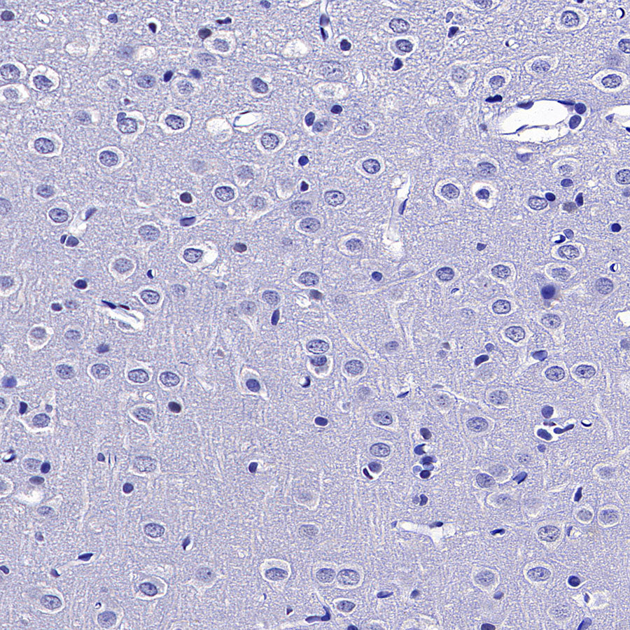 ROR beta/RORB Recombinant Rabbit mAb (S-5483)