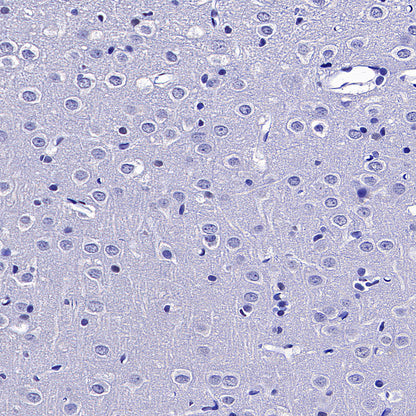 ROR beta/RORB Recombinant Rabbit mAb (S-5483)