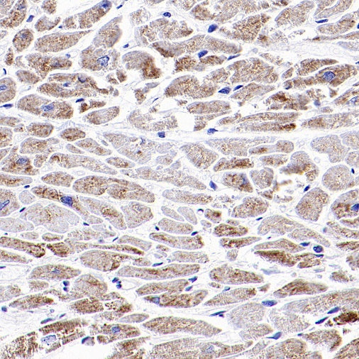 PDLI7/LMP1 Recombinant Rabbit mAb (S-2150-68)