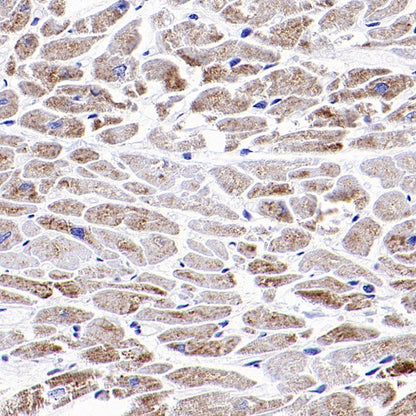 PDLI7/LMP1 Recombinant Rabbit mAb (S-2150-68)