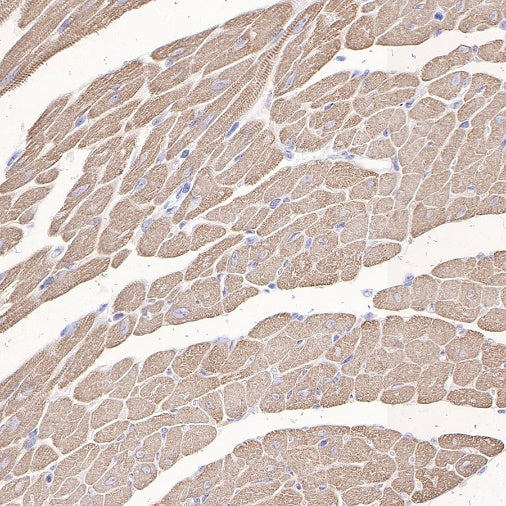 Myosin light chain 3 Recombinant Rabbit mAb (S-664-75)