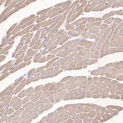 Myosin light chain 3 Recombinant Rabbit mAb (S-664-75)