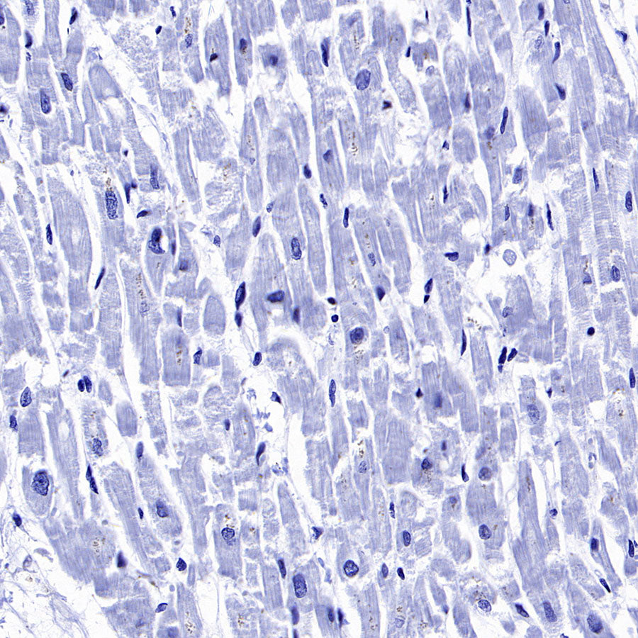 YTHDC2 Recombinant Rabbit mAb (S-3338-41)