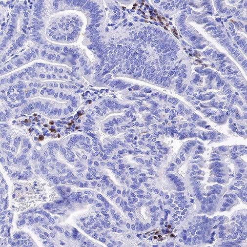 IRF4 Recombinant Rabbit mAb (S-654-33)