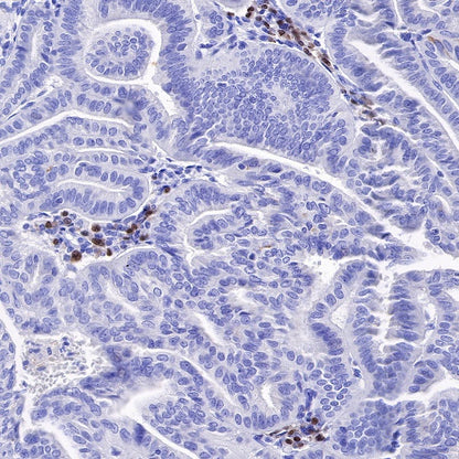 IRF4 Recombinant Rabbit mAb (S-654-33)