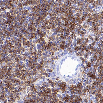 S-RMab®CD4 Recombinant Rabbit mAb (S-R569)