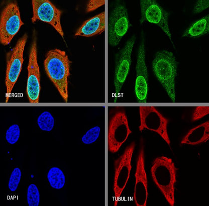 DLST Rabbit Polyclonal Antibody