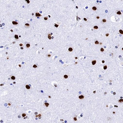 TAF15 Recombinant Rabbit mAb (S-1508-53)