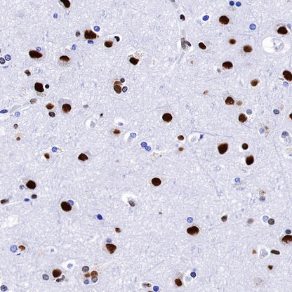 TAF15 Recombinant Rabbit mAb (S-1508-53)