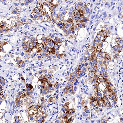 Claudin 3+Claudin 9 Recombinant Rabbit mAb (SDT-1452-80)